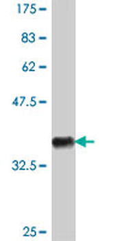 CASP10 polyclonal antibody (A01)