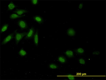 CASP9 monoclonal antibody (M01), clone 3B8-4G2