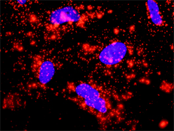 CASP9 monoclonal antibody (M01), clone 3B8-4G2
