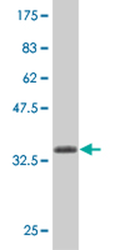 CASP2 monoclonal antibody (M10), clone 1C11