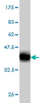 CASP1 monoclonal antibody (M01), clone 3D2