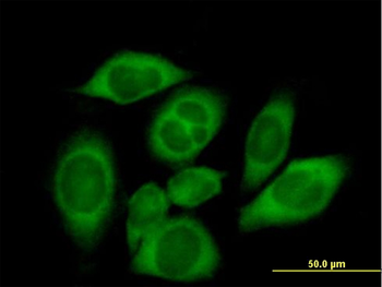 CARS purified MaxPab mouse polyclonal antibody (B01P)