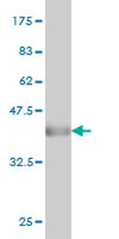 CAPZB monoclonal antibody (M03), clone 4H8