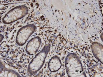 CAPZB monoclonal antibody (M02), clone 1H1