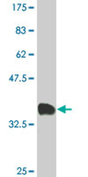 CAPZB monoclonal antibody (M02), clone 1H1