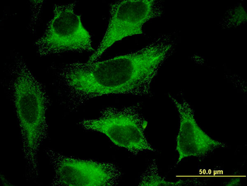 CAST monoclonal antibody (M03), clone 2C5