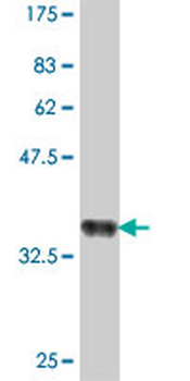 CAPZA1 polyclonal antibody (A02)