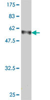 CAPZA1 polyclonal antibody (A01)