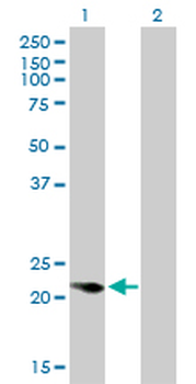 CAPS monoclonal antibody (M01), clone 4C6
