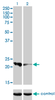 CAPS monoclonal antibody (M01), clone 4C6