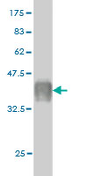 CAPS monoclonal antibody (M01), clone 4C6