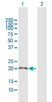 CAPS MaxPab rabbit polyclonal antibody (D01)