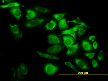 CAPG monoclonal antibody (M02), clone 6D6