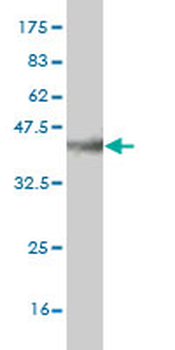 CAPG monoclonal antibody (M02), clone 6D6