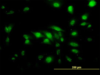 CAPG monoclonal antibody (M01), clone 1F1