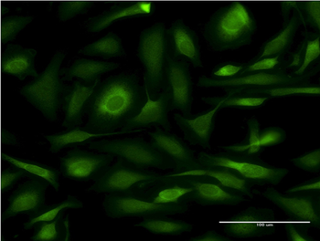 CANX monoclonal antibody (M08), clone 1D4