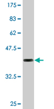 CANX monoclonal antibody (M08), clone 1D4