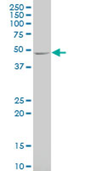 CAMK2A monoclonal antibody (M01), clone 2C4