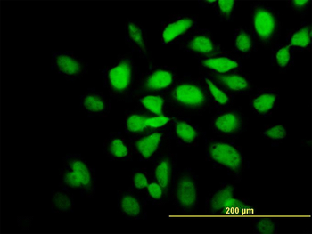 CAMK2A monoclonal antibody (M01), clone 2C4