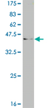 CAMK2A monoclonal antibody (M01), clone 2C4