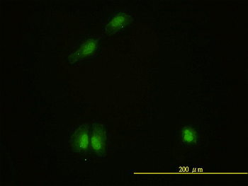 CAMK4 monoclonal antibody (M01), clone 1A3
