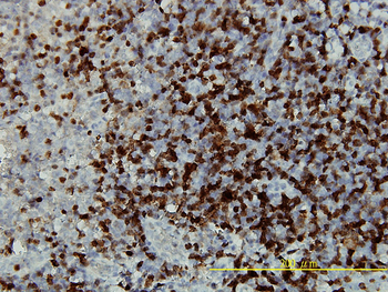 CAMK4 monoclonal antibody (M01), clone 1A3