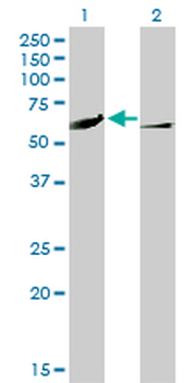 CAMK4 monoclonal antibody (M01), clone 1A3
