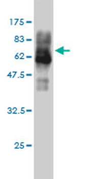 CAMK4 monoclonal antibody (M01), clone 1A3