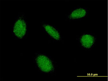CAMK4 purified MaxPab mouse polyclonal antibody (B01P)