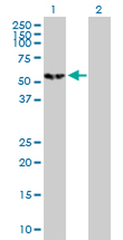 CAMK4 purified MaxPab mouse polyclonal antibody (B01P)