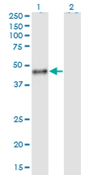 CALU monoclonal antibody (M02), clone 6C8