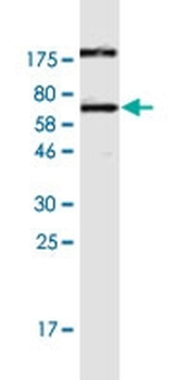 CALU monoclonal antibody (M02), clone 6C8
