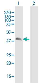 CALU purified MaxPab mouse polyclonal antibody (B01P)