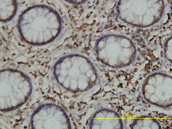 CALR monoclonal antibody (M01), clone 1G11-1A9