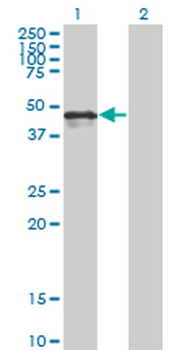 CALR monoclonal antibody (M01), clone 1G11-1A9