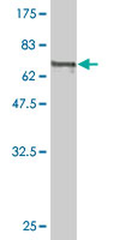 CALR monoclonal antibody (M01), clone 1G11-1A9