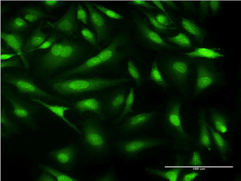 CALML3 monoclonal antibody (M04), clone 2A11