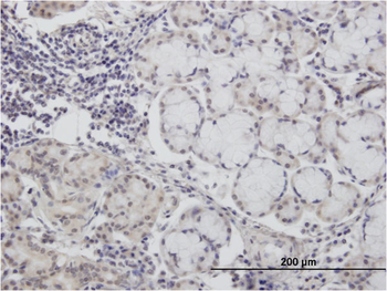CALML3 monoclonal antibody (M04), clone 2A11