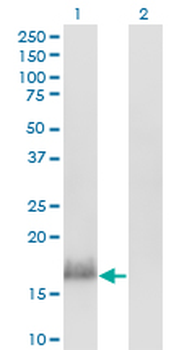CALML3 monoclonal antibody (M04), clone 2A11