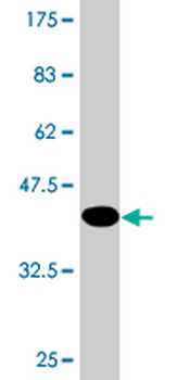 CALML3 monoclonal antibody (M04), clone 2A11