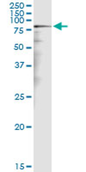 CALD1 MaxPab rabbit polyclonal antibody (D01)