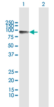 CALD1 MaxPab rabbit polyclonal antibody (D01)