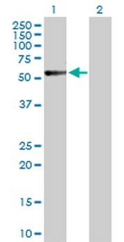CALCR purified MaxPab rabbit polyclonal antibody (D01P)