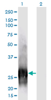 CALB1 monoclonal antibody (M01), clone 1F6