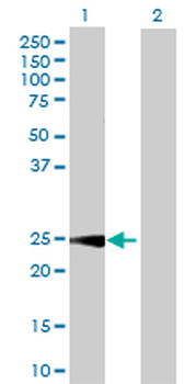 CALB1 purified MaxPab rabbit polyclonal antibody (D01P)