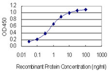 CACNB4 monoclonal antibody (M01), clone 7E1