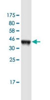 CACNB4 monoclonal antibody (M01), clone 7E1