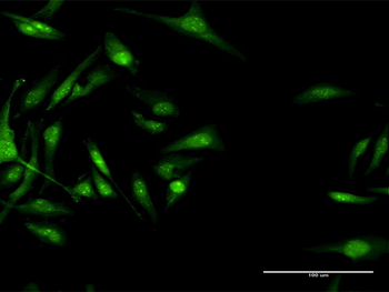 CACNB3 MaxPab rabbit polyclonal antibody (D01)