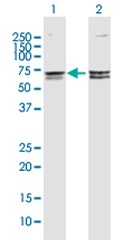 CACNB3 MaxPab rabbit polyclonal antibody (D01)