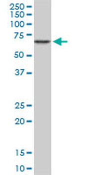 CACNB2 monoclonal antibody (M05), clone 6C4